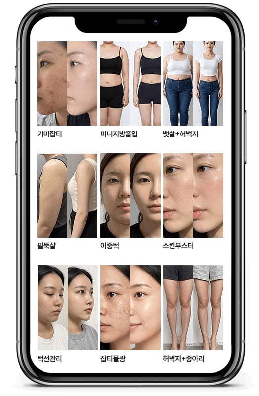 병의원 시술 카테고리별 AI 이미지가 정리된 모바일 화면