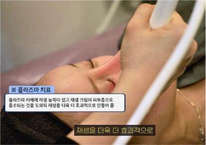 시술 과정을 설명하는 숏폼 콘텐츠 썸네일